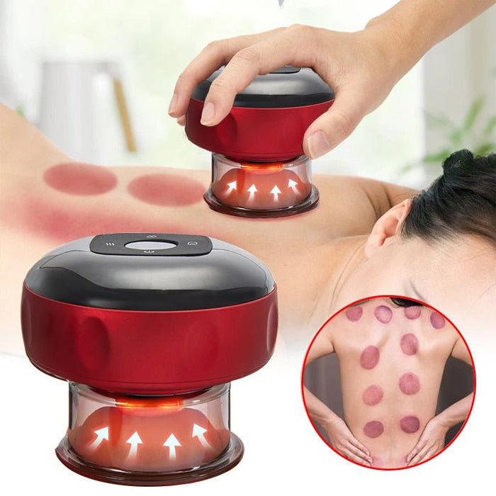 ProSuction Electric Cupping Set - Flamin' Fitness
